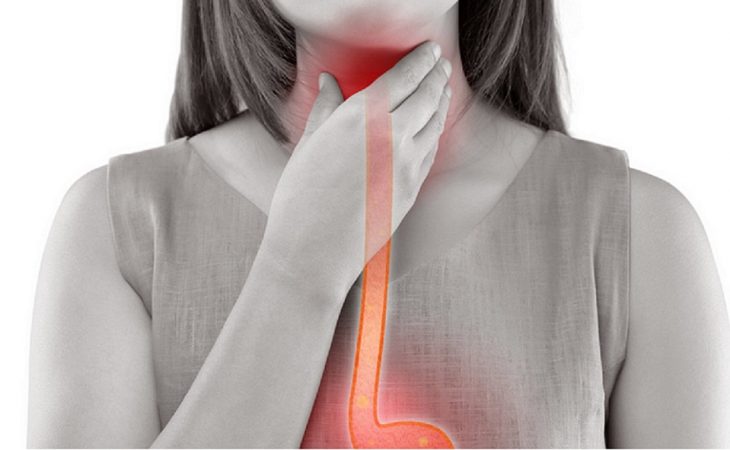 Natural Remedies for Sore Throat