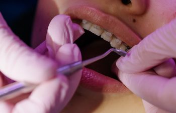 Dental Issues Experienced by Pediatrics