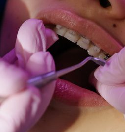 Dental Issues Experienced by Pediatrics